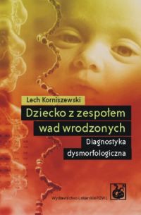Dziecko z zespołem wad wrodzonych