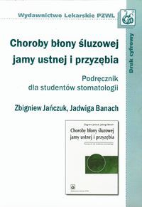 Choroby błony śluzowej jamy ustnej i przyzębia Podręcznik dla studentów stomatologii