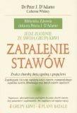 Zapalenie stawów