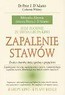 Zapalenie stawów
