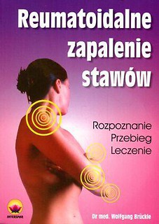 Reumatoidalne zapalenie stawów