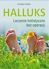 Halluks. Leczenie holistyczne bez operacji