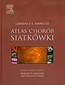 Atlas chorób siatkówki