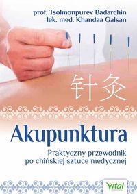 Akupunktura