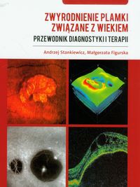 Zwyrodnienie plamki związane z wiekiem Przewodnik diagnostyki i terapii