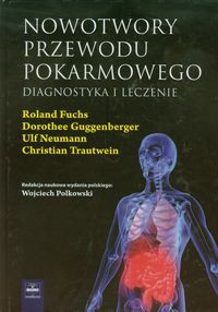 Nowotwory przewodu pokarmowego
